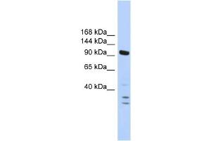WB Suggested Anti-PBRM1 Antibody Titration:  0. (Polybromo 1 antibody  (N-Term))