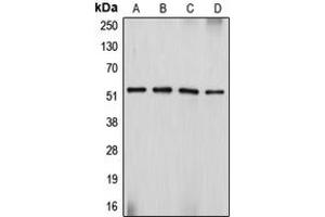 Western blot analysis of Desmin expression in Sol8 (A), HeLa (B), SJRH30 (C), PC12 (D) whole cell lysates.