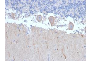 Formalin-fixed, paraffin-embedded human Brain stained with ATG5 Mouse Monoclonal Antibody (ATG5/2492).