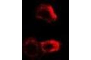 Immunofluorescent analysis of PYGB staining in MCF7 cells. (PYGB antibody)