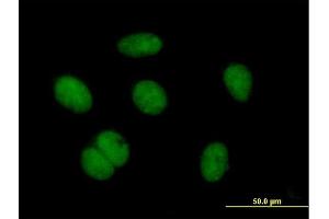 Immunofluorescence of purified MaxPab antibody to ZNF684 on HeLa cell.