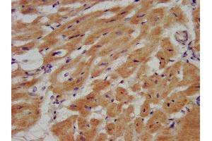 IHC image of ABIN7152355 diluted at 1:500 and staining in paraffin-embedded human heart tissue performed on a Leica BondTM system.