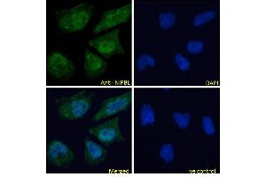 ABIN570861 Immunofluorescence analysis of paraformaldehyde fixed HeLa cells, permeabilized with 0.