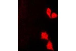 Immunofluorescent analysis of HUS1 staining in K562 cells. (HUS1 antibody)