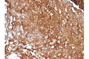 Immunohistochemistry (IHC) image for anti-beta-2-Microglobulin (B2M) antibody (ABIN6940415)