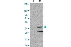 Western blot analysis of Lane 1: Negative control (vector only transfected HEK293T lysate). (OR8S1 antibody)