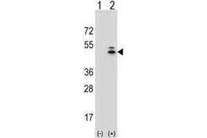 Western blot analysis of g-Actin antibody and 293 cell lysate (2 ug/lane) either nontransfected (Lane 1) or transiently transfected (2) with the ACTG1 gene. (Actin, gamma 1 antibody  (AA 188-215))