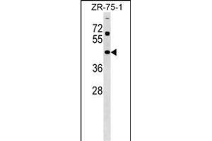 ZN Antibody (Center) (ABIN1538010 and ABIN2849144) western blot analysis in ZR-75-1 cell line lysates (35 μg/lane). (Zinc Finger and SCAN Domain Containing 31 (ZSCAN31) (AA 190-217) antibody)