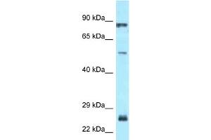 WB Suggested Anti-E2F1 Antibody Titration: 1. (E2F1 antibody  (Middle Region))