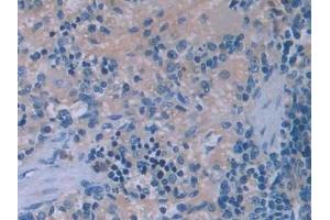 Detection of IL6 in Rat Spleen Tissue using Monoclonal Antibody to Interleukin 6 (IL6) (IL-6 antibody  (AA 21-211))