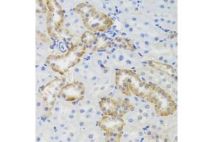 Immunohistochemistry of paraffin-embedded rat kidney using MTERFD3 antibody (ABIN5974877) at dilution of 1/100 (40x lens). (MTERFD3 antibody)