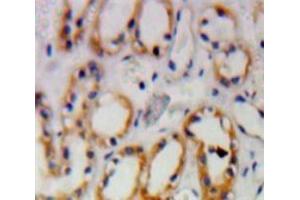 IHC-P analysis of Kidney tissue, with DAB staining. (PKN1 antibody  (AA 615-874))