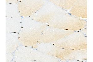 ABIN6256450 and ABIN6267096 at 1/100 staining Rat muscle tissue by IHC-P.