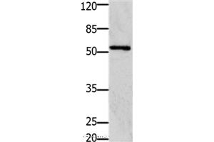 Western blot analysis of 293T cell, using GFRA1 Polyclonal Antibody at dilution of 1:1250 (GFRA1 antibody)
