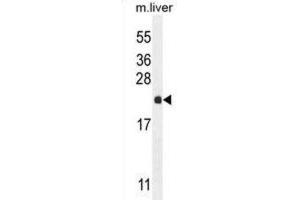 Western Blotting (WB) image for anti-Ribulose-5-Phosphate-3-Epimerase-Like (RPEL1) antibody (ABIN2995143) (Ribulose-5-Phosphate-3-Epimerase-Like (RPEL1) antibody)
