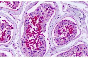 Anti-GPR75 antibody IHC staining of human testis. (GPR75 antibody  (Extracellular Domain))