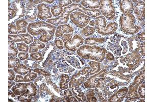 IHC-P Image MCD antibody [N2C1], Internal detects MCD protein at cytosol on mouse kidney by immunohistochemical analysis. (MLYCD antibody)