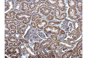 IHC-P Image MCD antibody [N2C1], Internal detects MCD protein at cytosol on mouse kidney by immunohistochemical analysis. (MLYCD antibody)