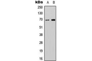 Western blot analysis of ATG16L2 expression in SHSY5Y (A), NIH3T3 (B) whole cell lysates. (ATG16L2 antibody  (Center))