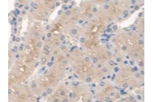 Detection of SPTLC1 in Mouse Kidney Tissue using Polyclonal Antibody to Serine Palmitoyltransferase, Long Chain Base Subunit 1 (SPTLC1) (SPTLC1 antibody  (AA 143-473))