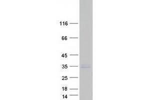 Western Blotting (WB) image for Prostate Transmembrane Protein, Androgen Induced 1 (PMEPA1) (Transcript Variant 4) protein (Myc-DYKDDDDK Tag) (ABIN2729205)