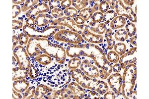 Immunohistochemistry analysis of paraffin-embedded Mouse kidney cancer using COX4I1 Polyclonal Antibody at dilution of 1:200. (COX IV antibody)