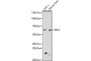 Western blot analysis of extracts of various cell lines, using IRF4 antibody (ABIN1680506, ABIN3015186, ABIN3015187 and ABIN6213873) at 1:1000 dilution. (IRF4 antibody  (AA 150-350))