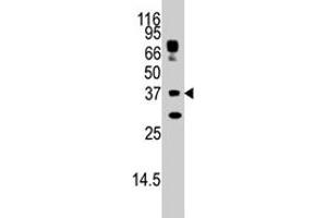 The STUB1 polyclonal antibody  is used in Western blot to detect STUB1 in HepG2 cell lysate. (STUB1 antibody  (AA 160-190))