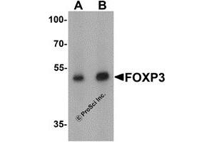 Western Blotting (WB) image for anti-Forkhead Box P3 (FOXP3) (C-Term) antibody (ABIN1077427) (FOXP3 antibody  (C-Term))