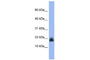 WB Suggested Anti-Cst6 Antibody Titration: 0. (CST6 antibody  (Middle Region))