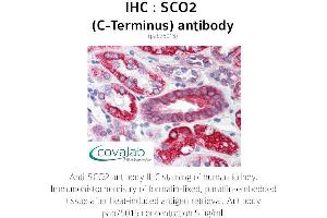 Image no. 1 for anti-SCO2 Cytochrome C Oxidase Assembly Protein (SCO2) antibody (ABIN1739069)