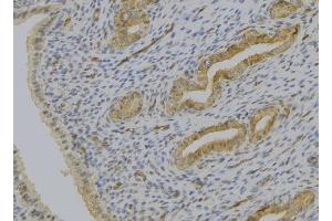 ABIN6277522 at 1/100 staining Human uterus tissue by IHC-P. (SERPINE2 antibody  (C-Term))