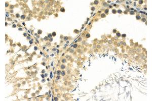 ABIN6261792 and ABIN6266895 at 1/100 staining Rat testis tissue by IHC-P. (FOXJ3 antibody  (C-Term))