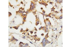 IHC-P: Cystathionase antibody testing of human liver tissue (CTH antibody  (C-Term))