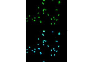 Immunofluorescence analysis of A549 cells using NR5A2 antibody (ABIN5973388). (NR5A2 + LRH1 antibody)