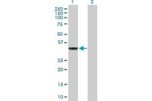 SULT1A3 antibody  (AA 1-295)