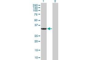 Western Blot analysis of SULT1A3 expression in transfected 293T cell line by SULT1A3 MaxPab polyclonal antibody. (SULT1A3 antibody  (AA 1-295))