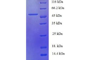 HUS1 Checkpoint Homolog (S. Pombe) (HUS1) (AA 2-280), (partial) protein (His-SUMO Tag)