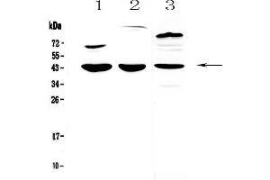 Western blot analysis of IL18 binding protein using anti-IL18 binding protein antibody . (IL18BP antibody  (AA 29-193))