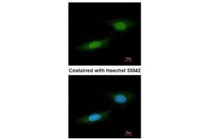 ICC/IF Image Immunofluorescence analysis of paraformaldehyde-fixed HeLa, using NLK, antibody at 1:100 dilution. (Nemo-Like Kinase antibody)