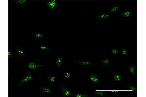Immunofluorescence of purified MaxPab antibody to NIP7 on HeLa cell.