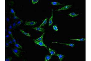 Immunofluorescent analysis of Hela cells using ABIN7147190 at dilution of 1:100 and Alexa Fluor 488-congugated AffiniPure Goat Anti-Rabbit IgG(H+L) (CD9 antibody  (AA 112-195))