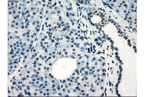 Immunohistochemical staining of paraffin-embedded colon tissue using anti-FRKmouse monoclonal antibody. (FRK antibody)