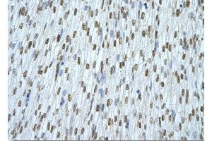 Rabbit Anti-HNRNPAB Antibody       Paraffin Embedded Tissue:  Human cardiac cell   Cellular Data:  Epithelial cells of renal tubule  Antibody Concentration:   4. (HNRNPAB antibody  (C-Term))