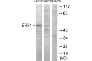 Western blot analysis of extracts from HuvEc cells, treated with PMA 125ng/ml 30', using ER81 Antibody. (ETV1 antibody  (AA 10-59))