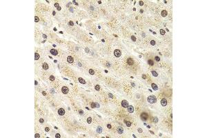 Immunohistochemistry (Paraffin-embedded Sections) (IHC (p)) image for anti-Heterogeneous Nuclear Ribonucleoprotein D (HNRNPD) (AA 1-306) antibody (ABIN6141905)