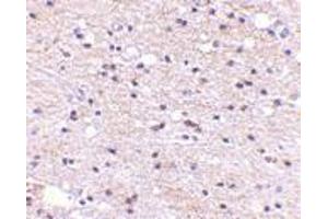 Immunohistochemistry of Ambra1 in human brain with Ambra1 antibody at 5 μg/ml. (AMBRA1 antibody  (C-Term))