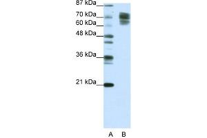 WB Suggested Anti-CTNNB1 Antibody Titration:  1. (CTNNB1 antibody  (C-Term))