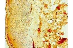 Immunohistochemistry of paraffin-embedded human skin tissue using ABIN7156848 at dilution of 1:100 (IL2 Receptor beta antibody  (AA 48-177))