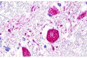 Image no. 2 for anti-MAS1 Oncogene Like Protein (MAS1L) (C-Term) antibody (ABIN1049042) (MAS1L antibody  (C-Term))